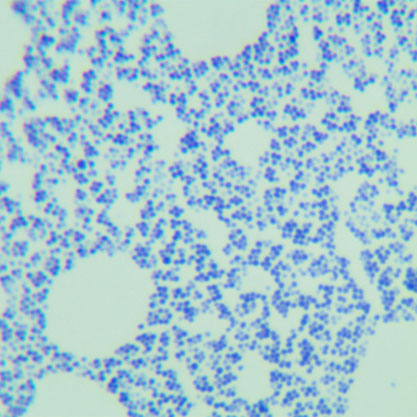 Staphylococcus lentus-BNCC