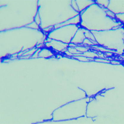 Saccharomonospora glauca-BNCC