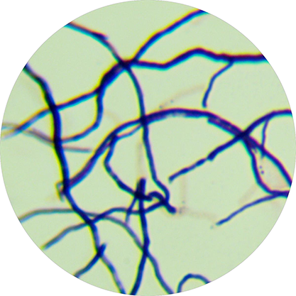 Streptomyces acidiscabies-BNCC