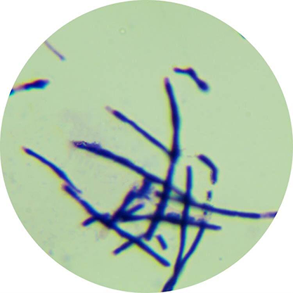 Pseudonocardia ammonioxydans-BNCC