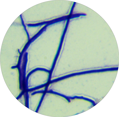 Streptomyces thermocarboxydus-BNCC