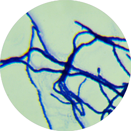 Streptomyces mobaraensis-BNCC