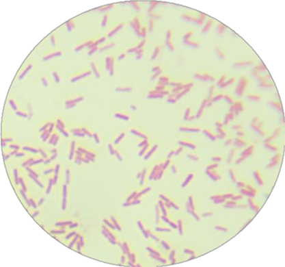 Pseudomonas aeruginosa-BNCC