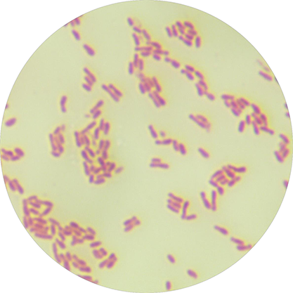 Agrobacterium tumefaciens-BNCC
