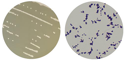 Staphylococcus lentus-BNCC