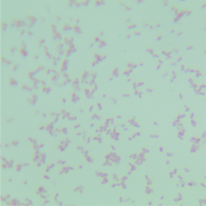 Escherichia coli-BNCC