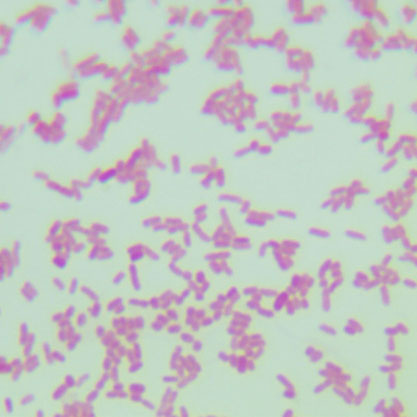 Escherichia coli-BNCC