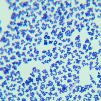 Corynebacterium glutamicum-BNCC