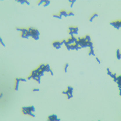 Bifidobacterium breve-BNCC