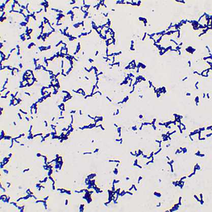 Bifidobacterium adolescentis-BNCC