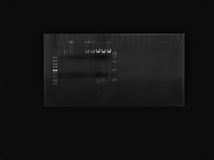 Stenotrophomonas maltophilia-BNCC