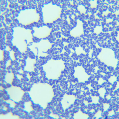 Listeria monocytogenes-BNCC