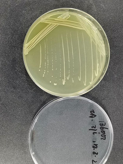 Mycobacterium abscessus-BNCC