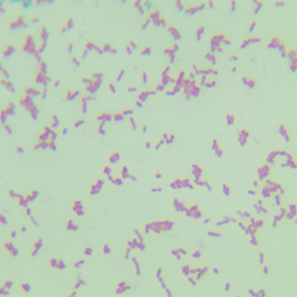 Actinobacillus succinogenes-BNCC