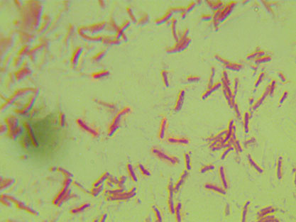 Citrobacter freundii-BNCC