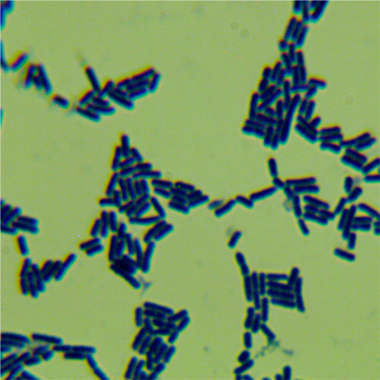 Clostridium sordellii-BNCC