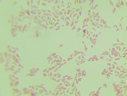 Escherichia coli EPEC-BNCC