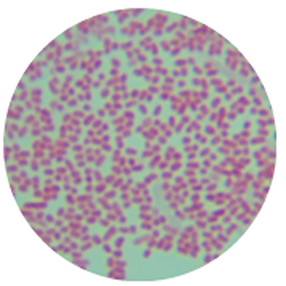 Escherichia coli ETEC-BNCC
