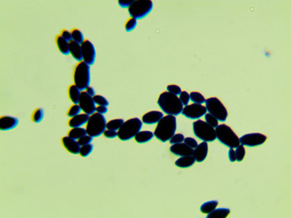 Saccharomyces cerevisiae-BNCC