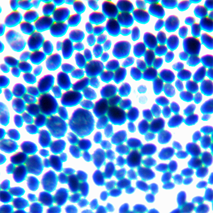 Saccharomyces cerevisiae-BNCC