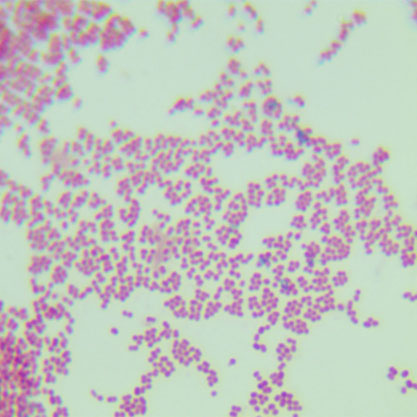 Acinetobacter pitte-BNCC