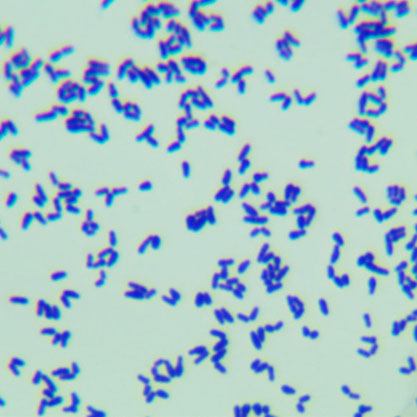 Corynebacterium pekinense-BNCC