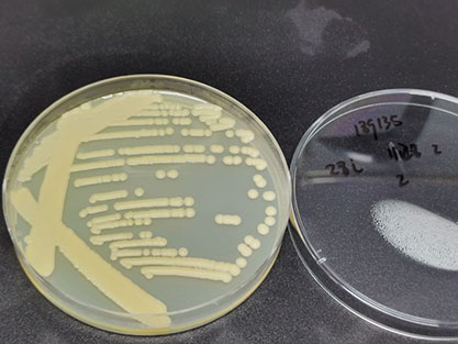 Cryptococcus laurentii-BNCC