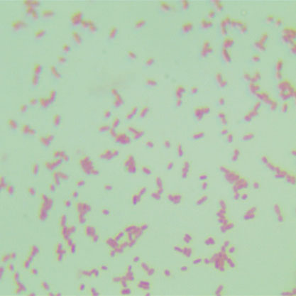 Escherichia coli EHEC O157:H7-BNCC