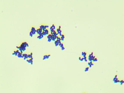 Corynebacterium glutamicum-BNCC