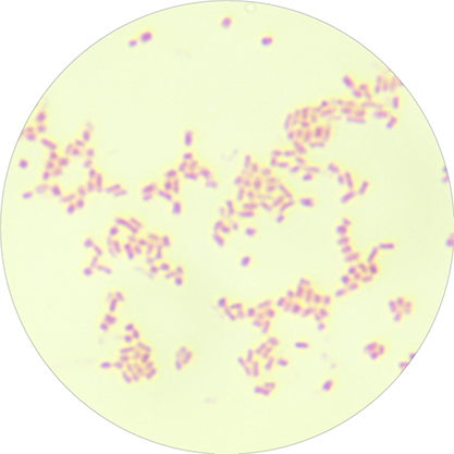 Escherichia coli EPEC O86:K61-BNCC