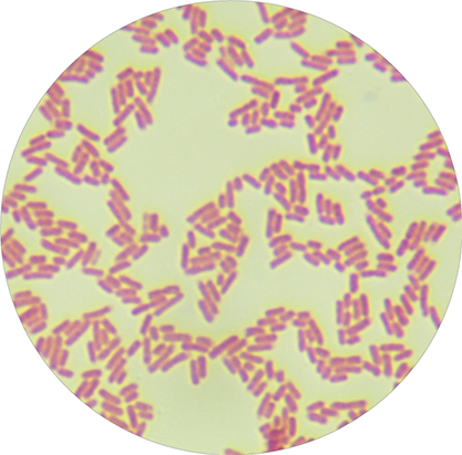 Escherichia coli ETEC O25:K19-BNCC