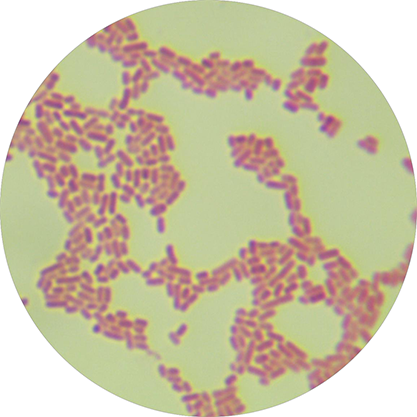 Escherichia coli-BNCC