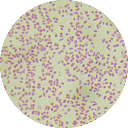 Vibrio parahaemolyticus-BNCC