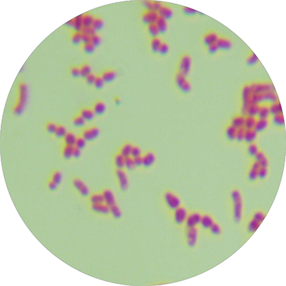 Rhizocococcus purpurpura (Rhizococcus rosei)-BNCC