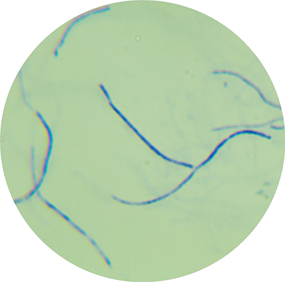 Streptomyces roseoflavus-BNCC