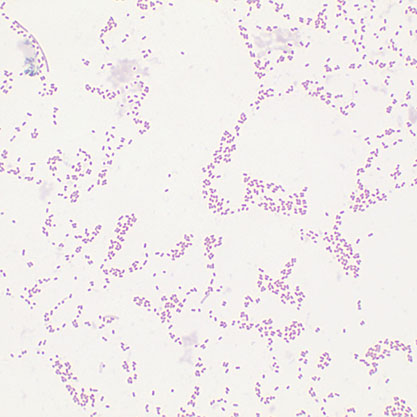 Bacteroides caccae Johnson et al.-BNCC
