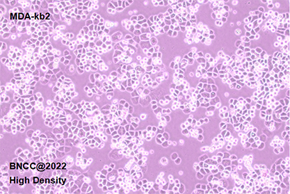 Human mammary cells-BNCC