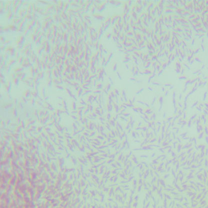 Campylobacter jejuni subsp. jejuni (Jones et al.) Veron and Chatelain-BNCC