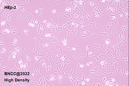 Human laryngeal epidermoid cancer cells (recognized as contaminated by HELA)-BNCC