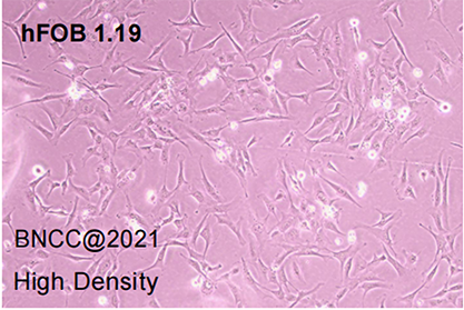 Human SV40 transfected osteoblasts-BNCC
