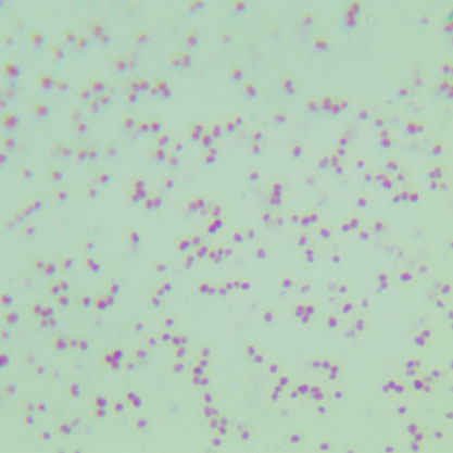 Neisseria gonorrhoeae-BNCC