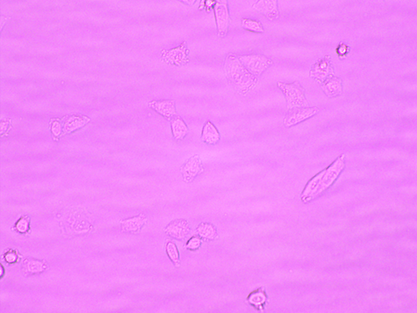 Human liposarcoma cells-BNCC