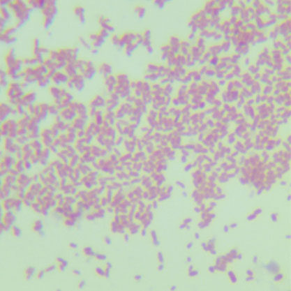 Enterobacter carcinogenes-BNCC