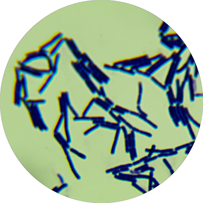 Clostridium novyi (Migula) Bergey et al.-BNCC