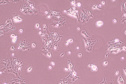 Mouse mammary epithelial cells-BNCC