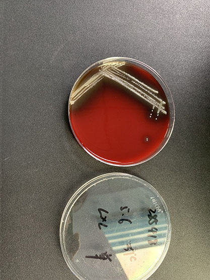 Salmonella enterica subsp.‖houtenae (Le Minor et al.) Le Minor and Popoff-BNCC