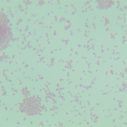 Bordetella parapedussis PT28G-BNCC