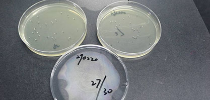 Cryptococcus neoformans var. grubii-BNCC