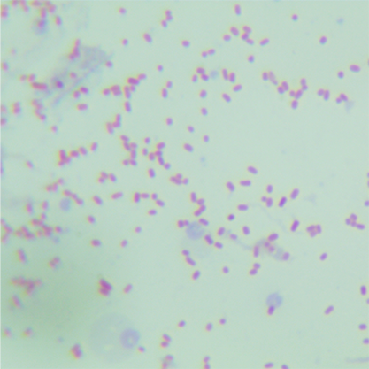 Escherichia coli (Migula) Castellani and Chalmers-BNCC