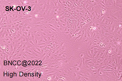 Human ovarian cancer cell-BNCC
